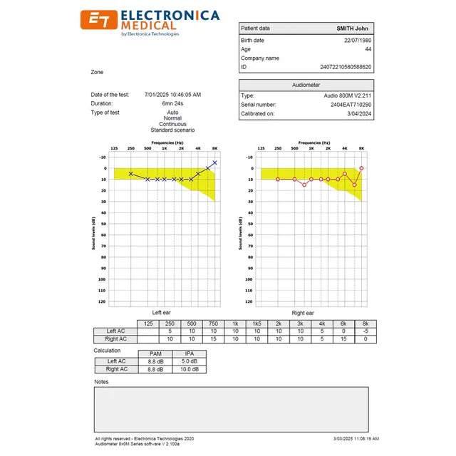 Electronica 800M PC Based Audiometer