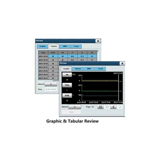Northern Venus Operating Patient Monitor